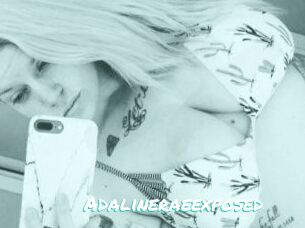 Adalinerae_exposed