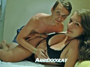 Annexxxray