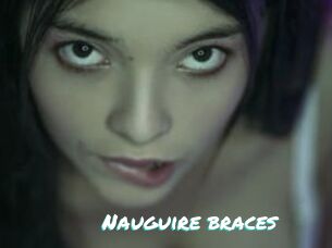 Nauguire_braces