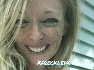 Xfreckledx